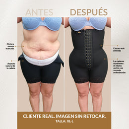 Luxury Queen wide hip girdle: Ideal for BBL (Ref. LUXBBL-013 / LUXBBL-213)