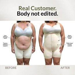 Post-surgical hourglass girdle: Defines waist and enhances buttocks (Ref. O-011 / O-211)